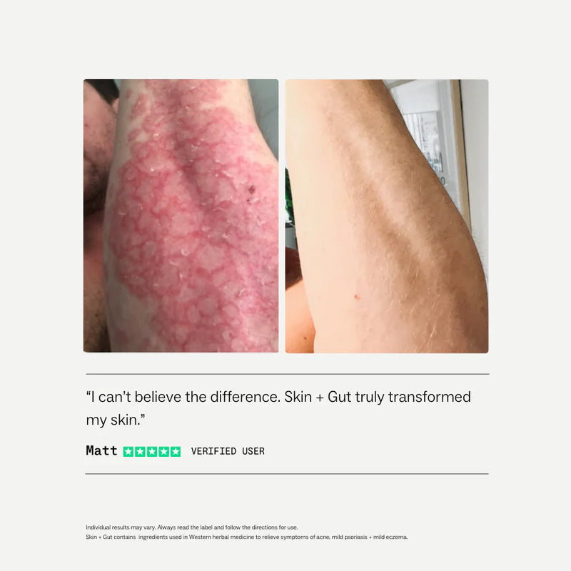 My Way Up - Skin + Gut