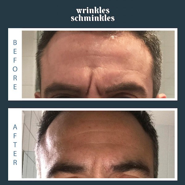 Wrinkles Schminkles Men's Forehead Smoothing Kit - CULT COSMETICA
