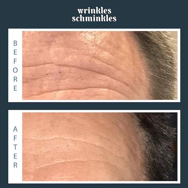 Wrinkles Schminkles Men's Forehead Smoothing Kit - CULT COSMETICA